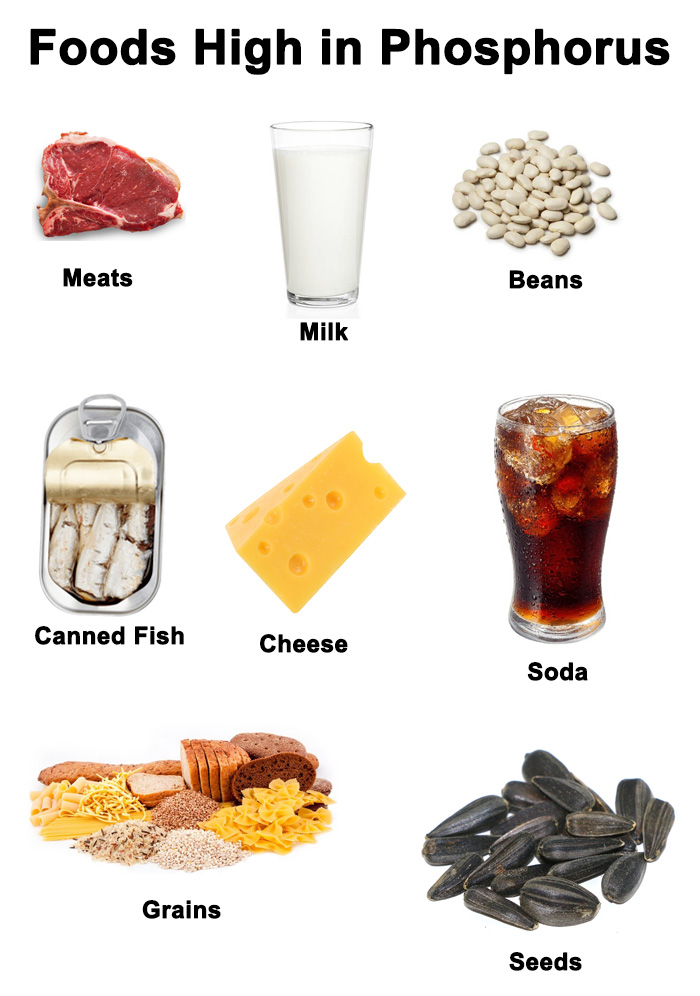 Kidney Failure